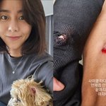 '철인 3종 도전' 유이, <b>피범벅</b> 된 꿀벅지... "끝까지 해본다...