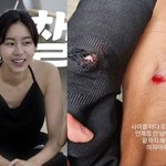 꿀벅지 유이, 근육질 요정 <b>진화</b> 중…피가 철철 나는 다리 “끝까지...