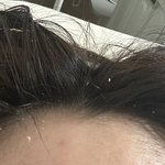 [댓글부탁해] <b>머리</b>안감은지10일차