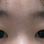 [댓글부탁해] <b>쌍수</b>하고싶은데 잘될지 모르겠어..