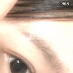 <b>쌍수</b>7년차인데 눈 어때?????