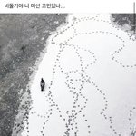 코성형은 티 안나기 <b>힘듬</b>?