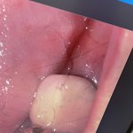 [이것좀봐줘] 너무어이없는 치과<b>의료</b>사고 봐주세요