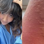 이혼' 이윤진, "온몸에 피부 <b>발진</b>...아들 아직 못 만나"