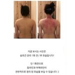 [드루와] 근데 승모근<b>마사지</b> 이거