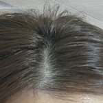 나 머리 빨리 자라는거냐