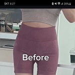 잇지 유나 <b>골반수술</b> 맞는듯