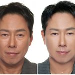 윤종신 확 달라진 얼굴, “정우성 닮았다” 극찬