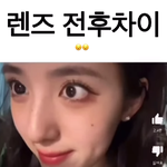 렌즈 <b>전후</b> 차이 이렇게 심한 사람?