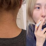 [댓글부탁해] '흡연 논란' 옥주현, 이번엔 목에 장침 꽂아 "흔치...