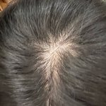 나 <b>정수리</b> 탈모 같음??