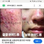 니 피부 <b>상태</b> 알려준다 8등급아