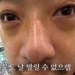 쌍수 거침없는 조언 부탁 !!