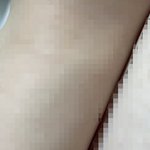나 거의 맨날 긴바지 입고 다녔더니 팔이랑 다리 피부