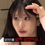 “탈모보험 있나요” 군통령 걸그룹의 고백, 300만원 들여 머리...