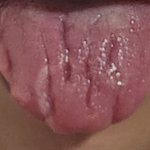 [댓글부탁해] 혀 평가좀요 따갑고 하루종일 <b>물마</b>셔도 갈증남