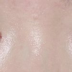 [댓글부탁해] 쌍수!!!!]좀 봐줘 ㅠㅠㅠ