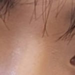 [댓글부탁해] <b>쌍수</b>하면 어떨거같음?