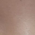 [댓글부탁해] 쌍수 할건데 조언좀