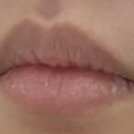 <b>입꼬리필러</b> 할까고민중