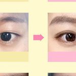 쌍수로 <b>성별</b>이 달라짐?