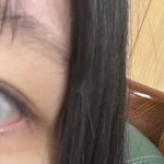 <b>언더</b>속눈썹 뽑음