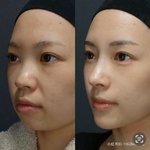 이게 성형으로 ㄹㅇ가능함….?