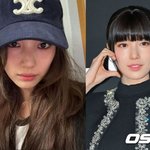 [단독] 수지, '눈동자 점' 제거 수술 완료...이유있는 '미모...