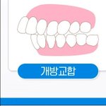 <b>돌출</b>입 교정해본사람?