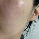 40대 <b>피부</b> 관리 안되서 답없는 사람들 조언