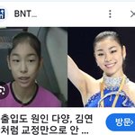 치아교정으로 <b>미인</b>형 얼굴로 180도 변신한 김연아