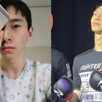 크아제<b>발섭</b>종?