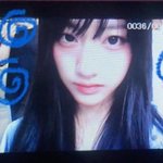 [댓글부탁해] 쌍수 해본애들 들어와봐 수술 <b>당일날</b>에