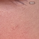 피부 ㅈㄴ뜨는데..ㅠㅠ