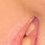 잇몸<b>교정</b> 같은 거 하면