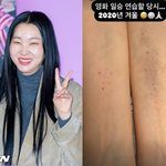 장윤주, 4년간 숨겨왔다...'피멍 가득' 두팔 공개 [<b>SHOT</b>...