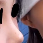 이거 <b>성형</b>코야??코<b>성형</b> 잘아는사람