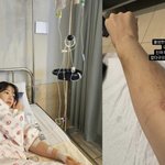 윤전일' <b>김보미</b>, 둘째 임신 중 안타까운 소식 전했다 "피 5통...