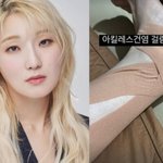 먹방 유튜버 <b>히밥</b>, 건강 이상.."아킬레스 건염 걸렸다"