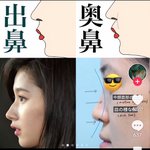 <b>왼쪽</b>처럼 되려면 다시 태어나는 거 말곤 답 없음?