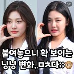 와 <b>닝닝</b> 인모드나 이런 거 한 걸까?