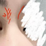 <b>T존</b>? 눈 옆 코 부분은 성형 안돼?