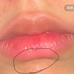 나 <b>입술</b>라인 이런데 어케해야댐