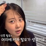 '박수홍' 김다예, 출산 후 75kg된 것도 서러운데 "M자 탈모오고...