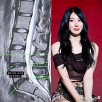 이채연, 허리 건강 적신호 "안 터진게 신기해…잠시 춤 <b>폐업</b>"