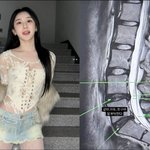 이채연, '정유라 탄핵 저격' 이은 악재…건강 악화 고백 "안...