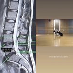 허리디스크 건강 적신호 “춤 잠깐 쉴 것… 내년에 정상영업” [왓<b>IS</b>]