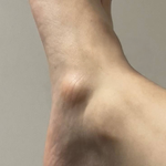 [댓글부탁해] 몸에  뼈가 하나 더있다네요…