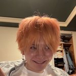 [트레저] 성형 <b>후유증</b>?