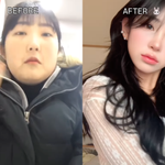 ‘故최진실 딸’ 최준희, 눈·코 했는데 양악 욕심..“︎남친이 못하게...